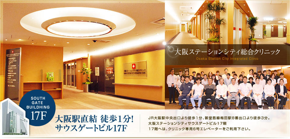 JR大阪駅中央出口より徒歩1分、御堂筋線梅田駅8番出口より徒歩3分。大阪ステーションシティサウスゲートビル17階。17階へは、クリニック専用6号エレベーターをご利用下さい。